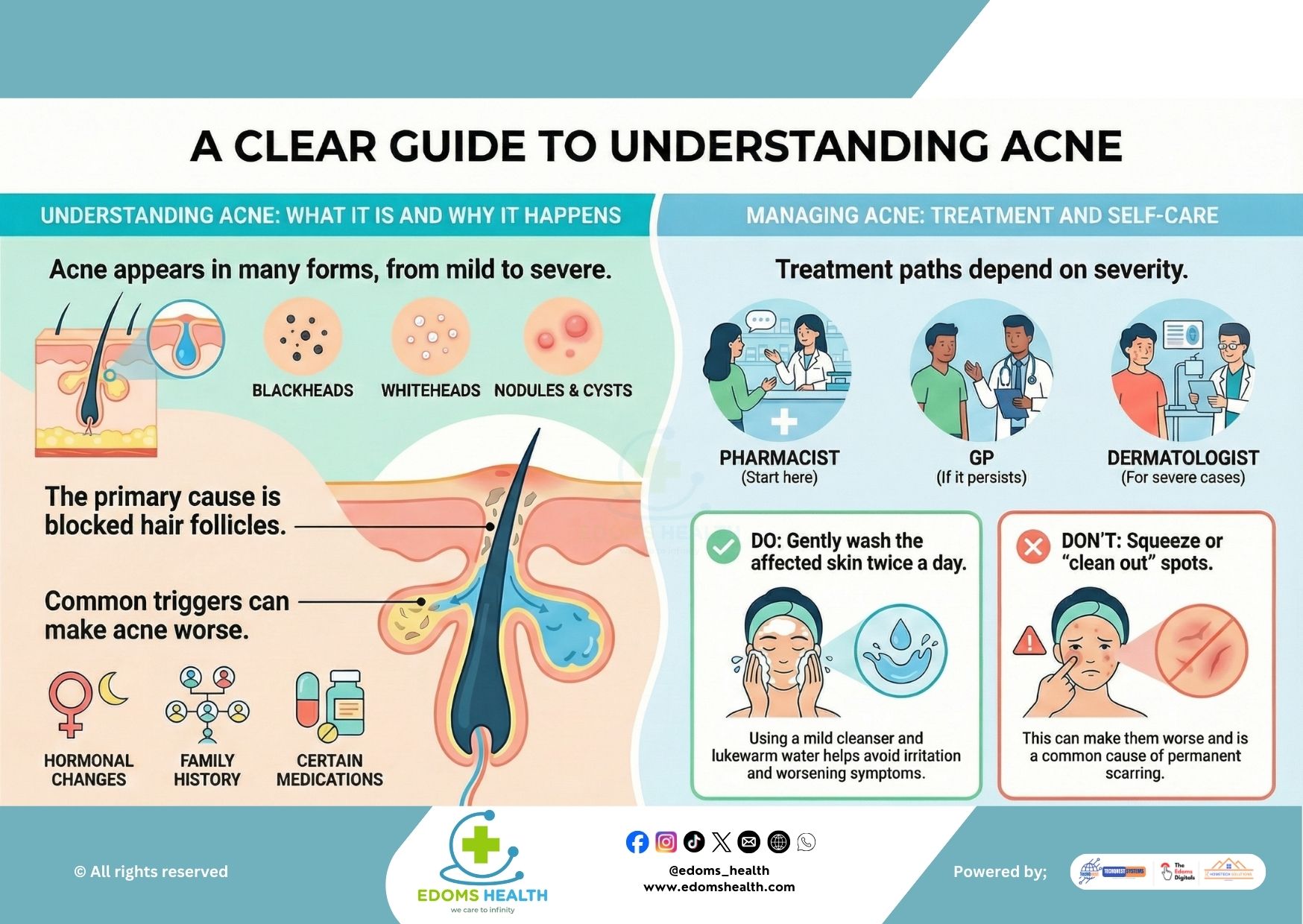 Understanding and Managing Acne