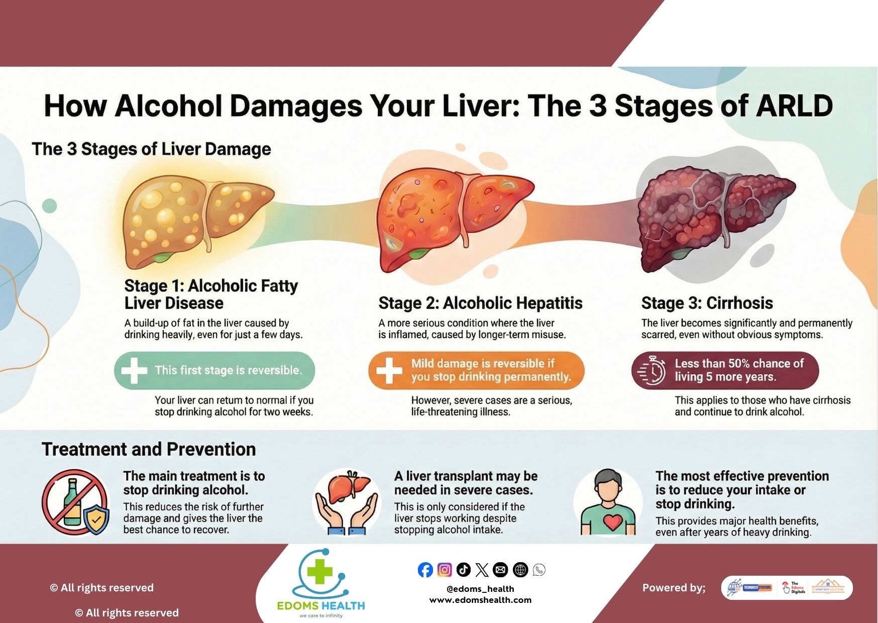 Understanding the 3 Stages of Alcohol-Related Liver Disease