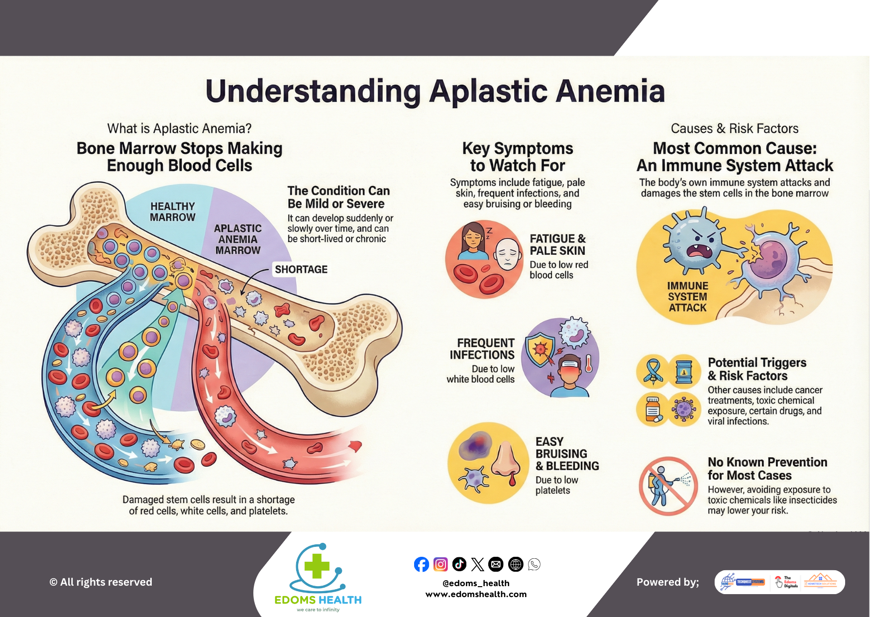 Understanding Aplastic Anemia: Causes, Symptoms, and Insights