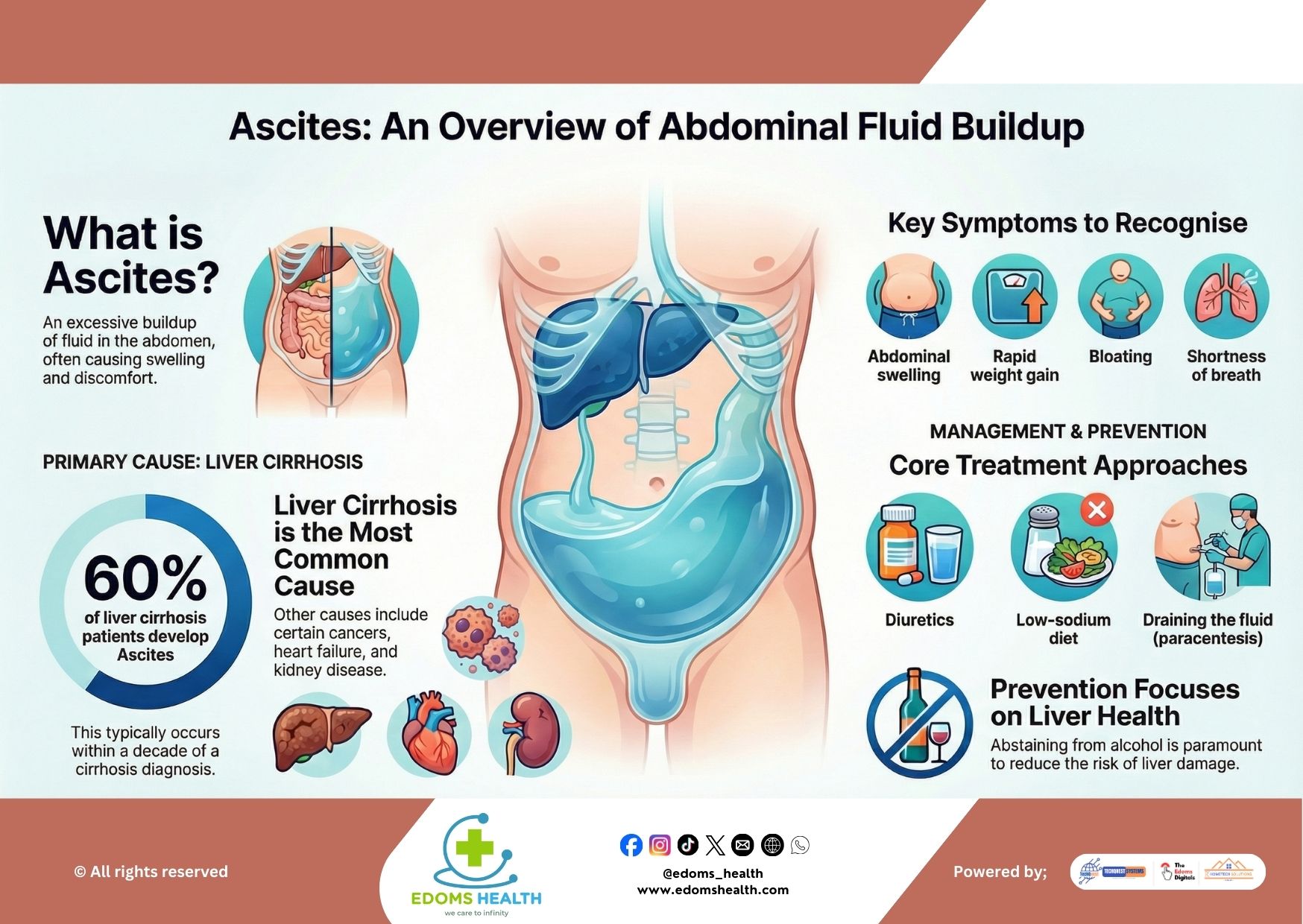 Ascites: Understanding and Managing Abdominal Fluid Buildup