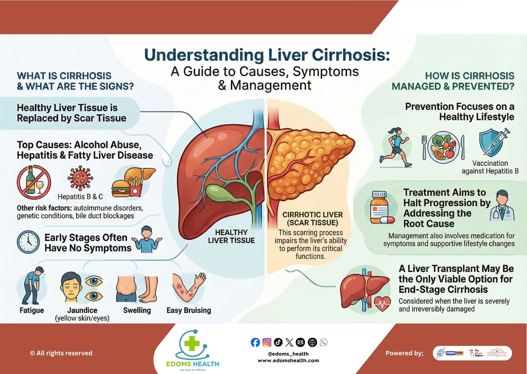 Understanding Liver Cirrhosis: A Guide to Causes, Symptoms & Management