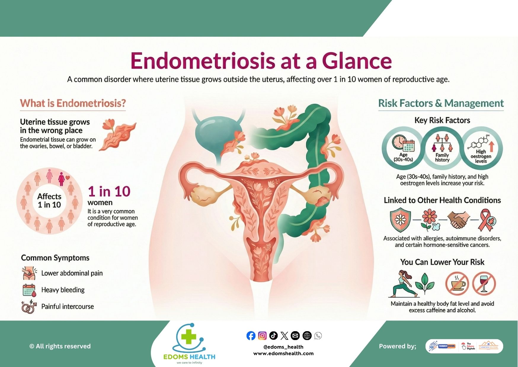 Endometriosis at a Glance: Understanding a Common Yet Overlooked Disorder